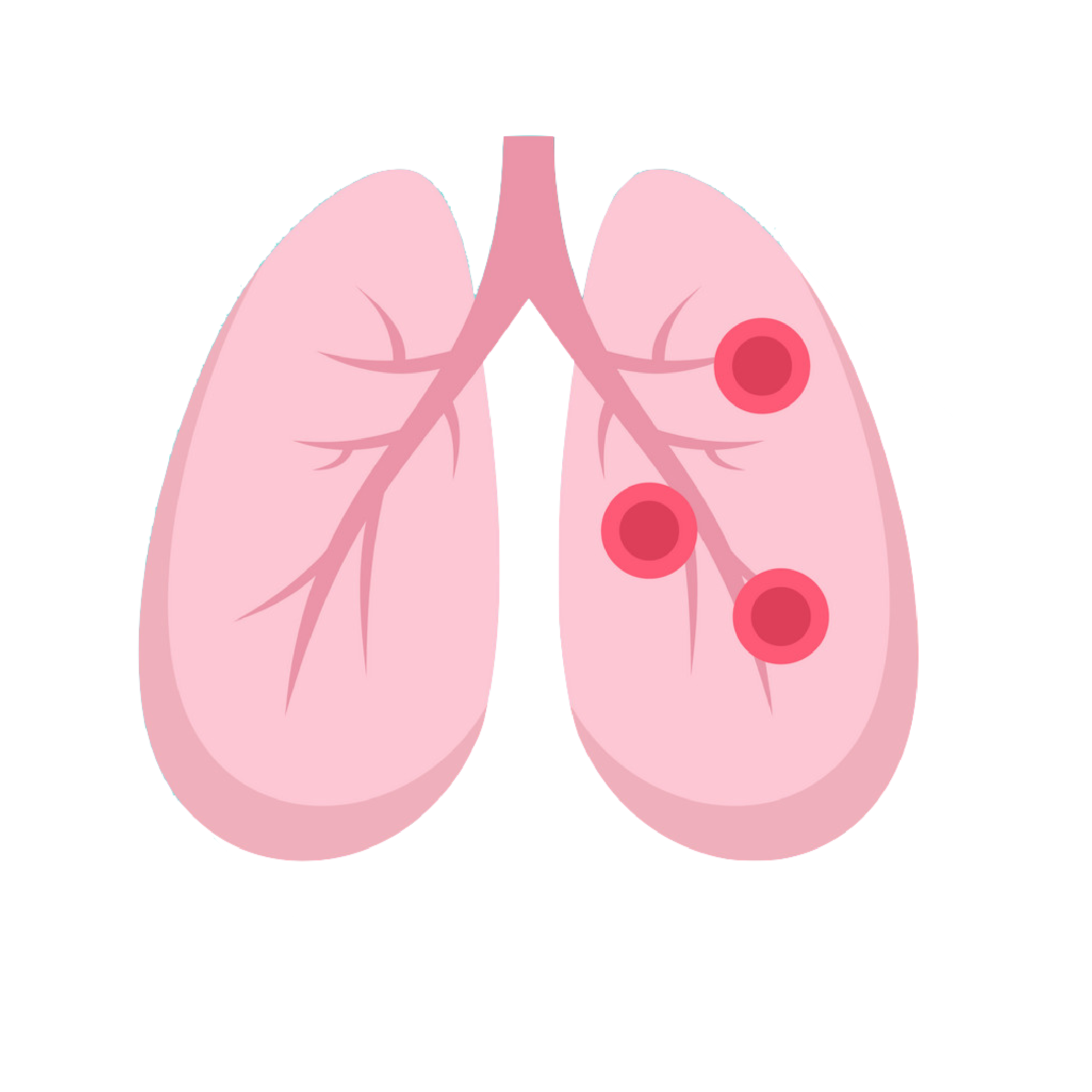 Allergic Bronchitis