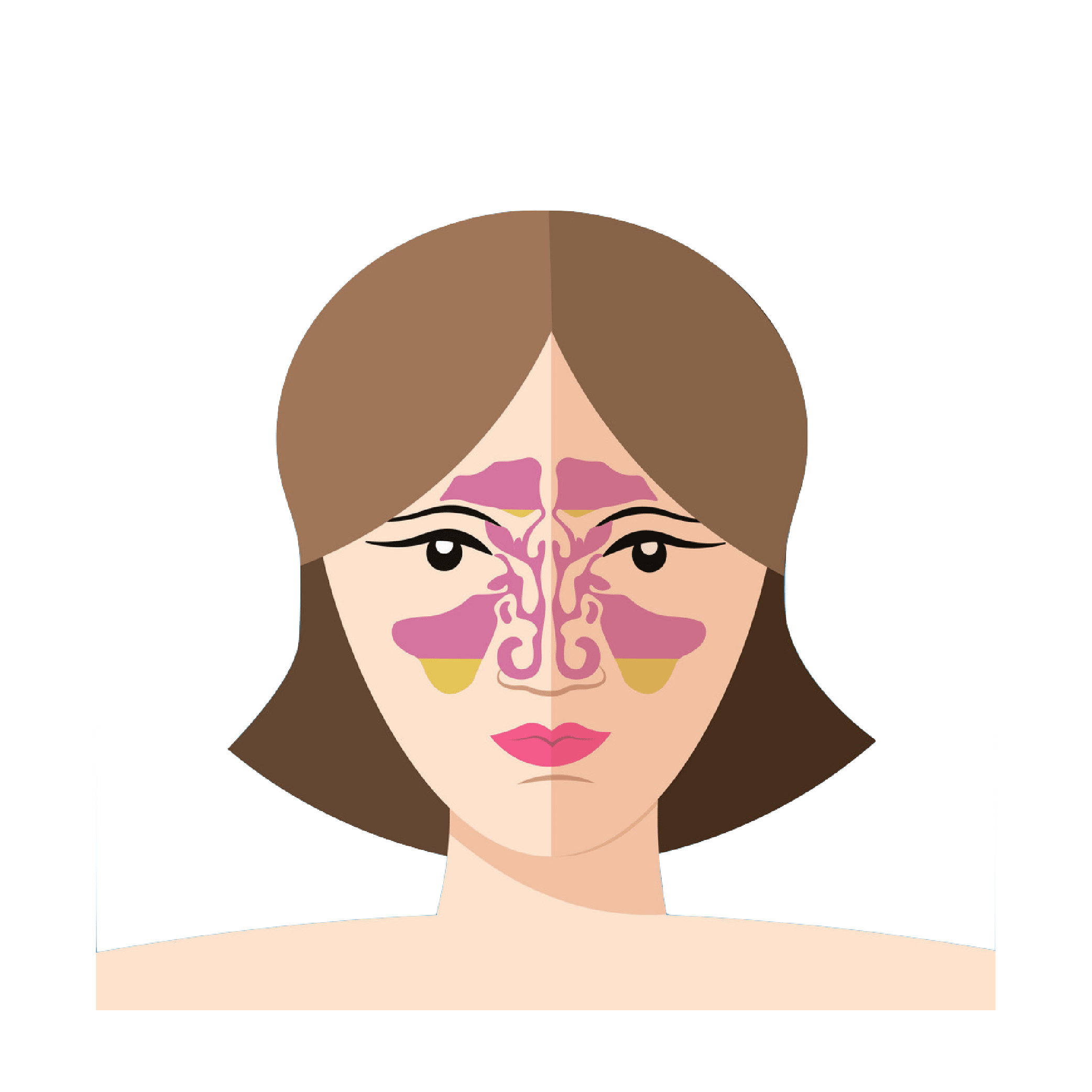 Sinusitis